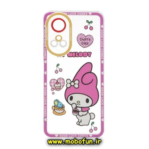 قاب گوشی Honor X7 4G آنر ژله ای شفاف فانتزی طرح کارتونی محافظ لنز دار کد 47