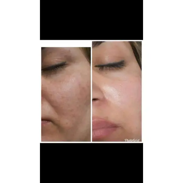 صابون روشن کننده و لایه بردار دکتر بیز