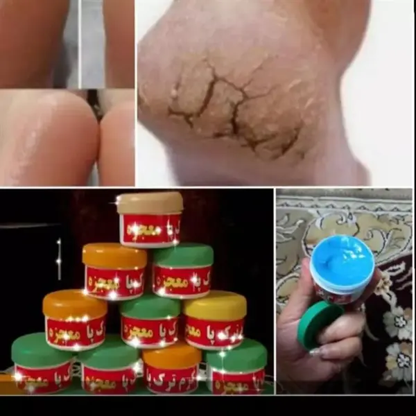 کرم ترک پا سینره حاوی روغن زیتون و گل راعی و رز وحشی و کالندولا 65 میلی لیتری