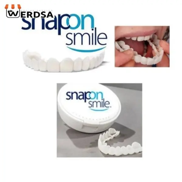 لمینت متحرک دندان دو فک اسنپ ان اسمایل snap on smile کد 1497