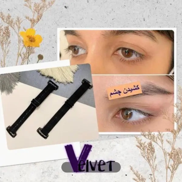 کش لیفت شقیقه و ابرو - 6