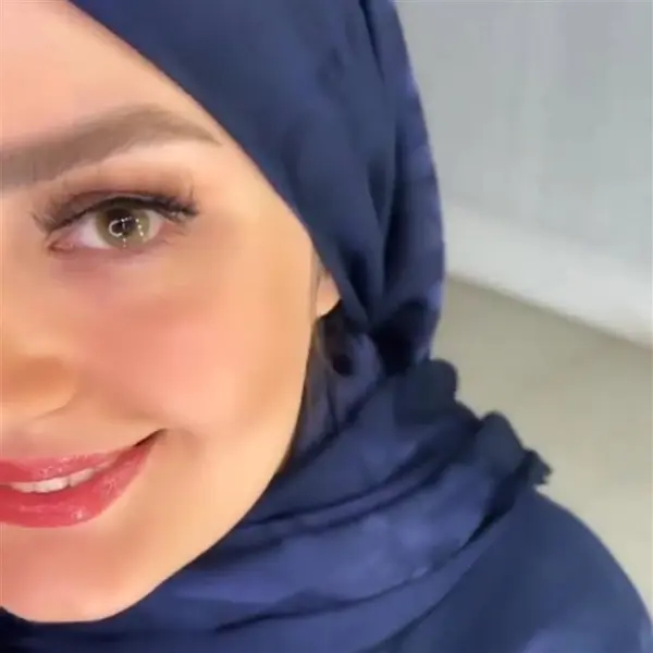 لنز چشم گریس هرا شماره 38 رنگ سبز عسلی - 5