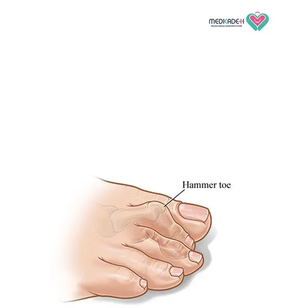 لا انگشتی همرتو طب و صنعت10800 - 6
