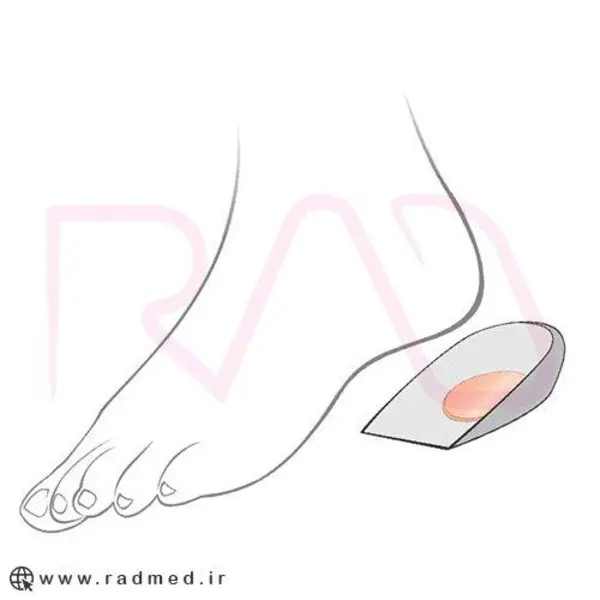 پد خار پاشنه سیلیکونی اوتسی کد TH-022 - 4